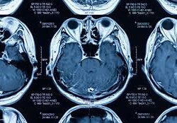 MRI Contrast Agent Manufacturers